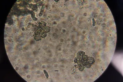 Entyloma ficariae