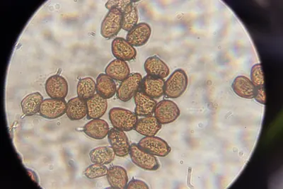 Uromyces ficariae