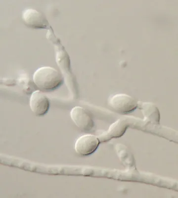 Scedosporium prolificans