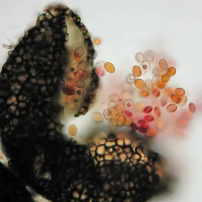 Pseudallescheria boydii