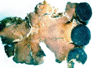 Fan lichen;   Felt lichen