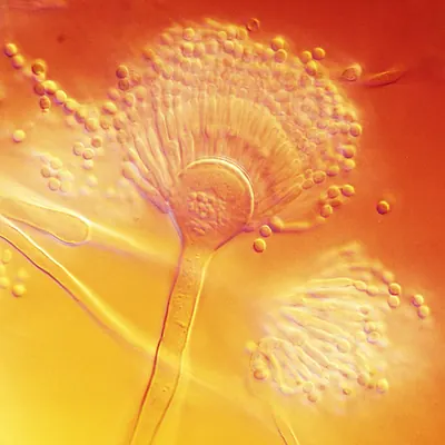 Aspergillus terreus